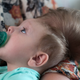 Bentley Yoder before the reconstructive surgery. (Image: Katherine C. Cohen/Boston Children’s Hospital)